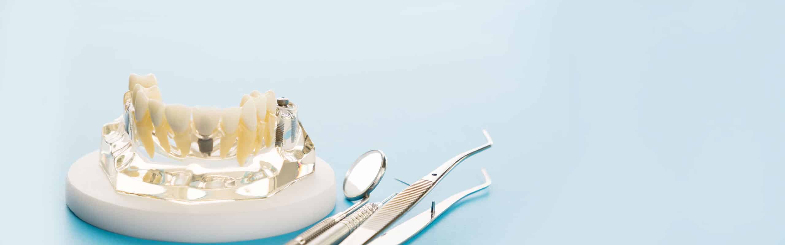 Dental Crowns & Bridges Gold Coast Dentist Lab Elite Dental Lab